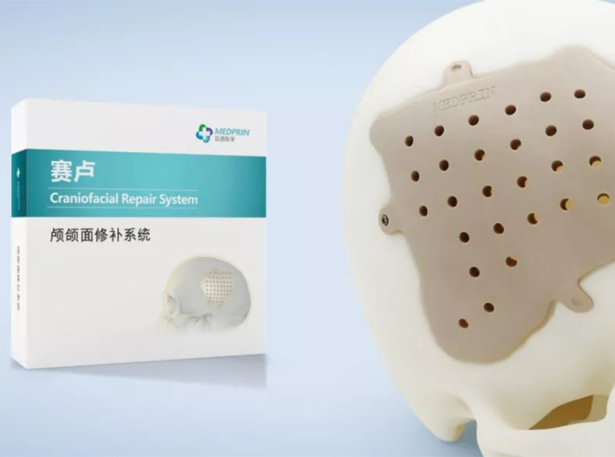 前額出現(xiàn)大坑怎么辦?賽盧修補(bǔ)后恢復(fù)原貌