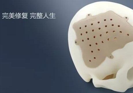 精準(zhǔn)定制,完美修復(fù)——從“頭”開始