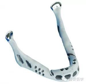 3D打印技術(shù)在骨科個(gè)體化治療方面的優(yōu)勢(shì)和應(yīng)用